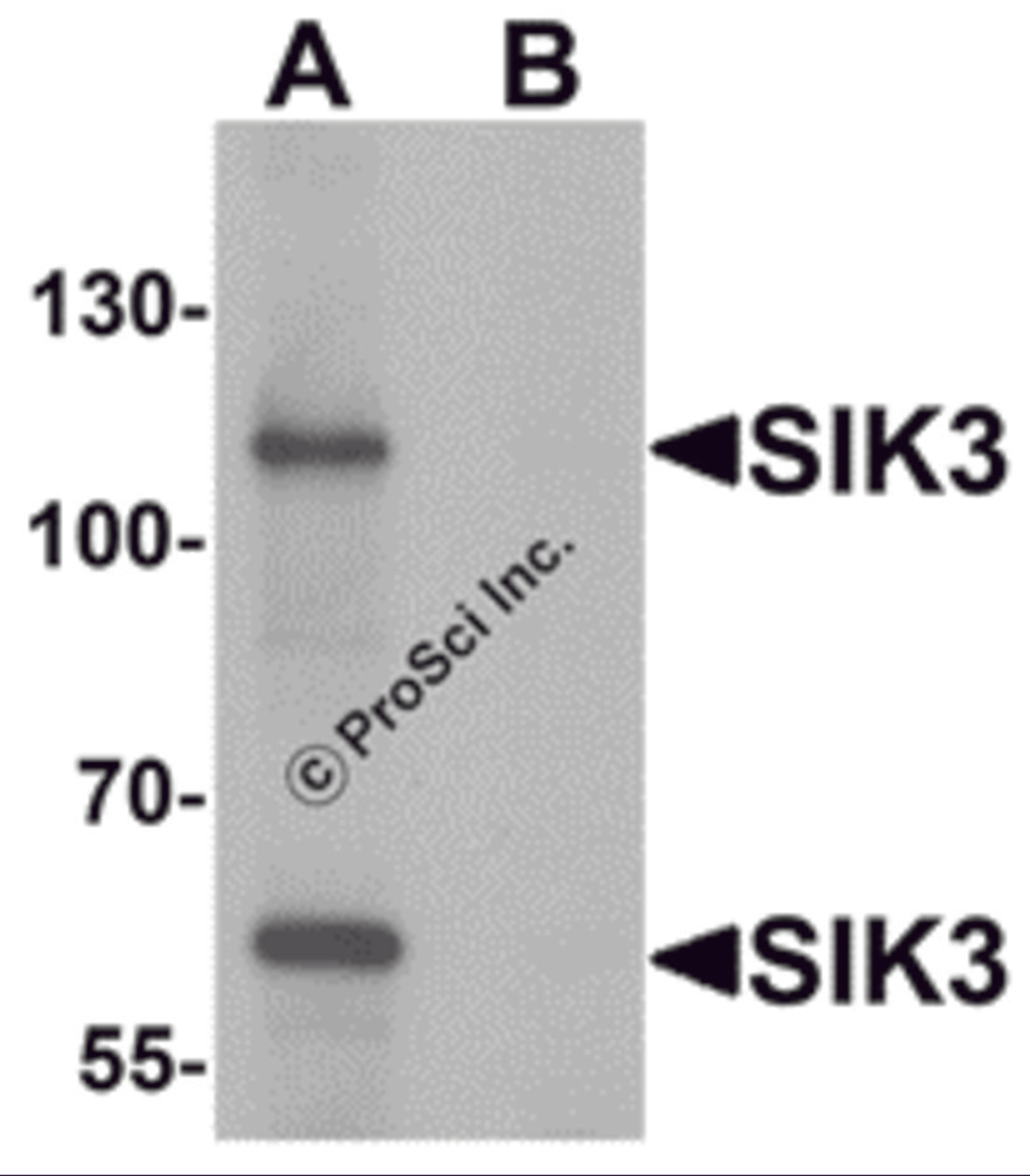 Western blot analysis of SIK3 in rat brain tissue lysate with SIK3 antibody at 1 μg/mL in (A) the absence and (B) the presence of blocking peptide.