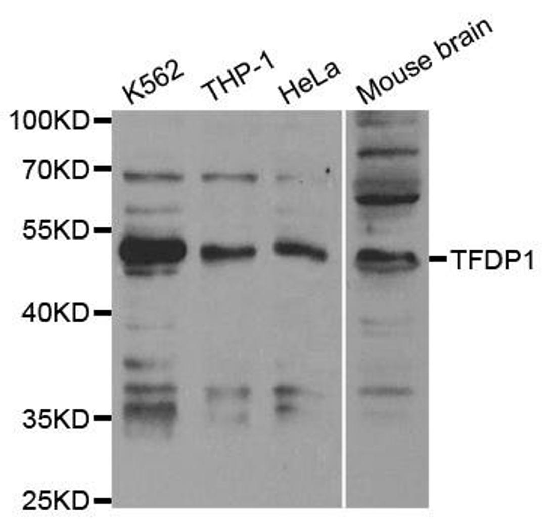 Western blot analysis of extracts of various cell lines using TFDP1 antibody