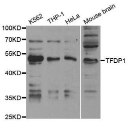 Western blot analysis of extracts of various cell lines using TFDP1 antibody