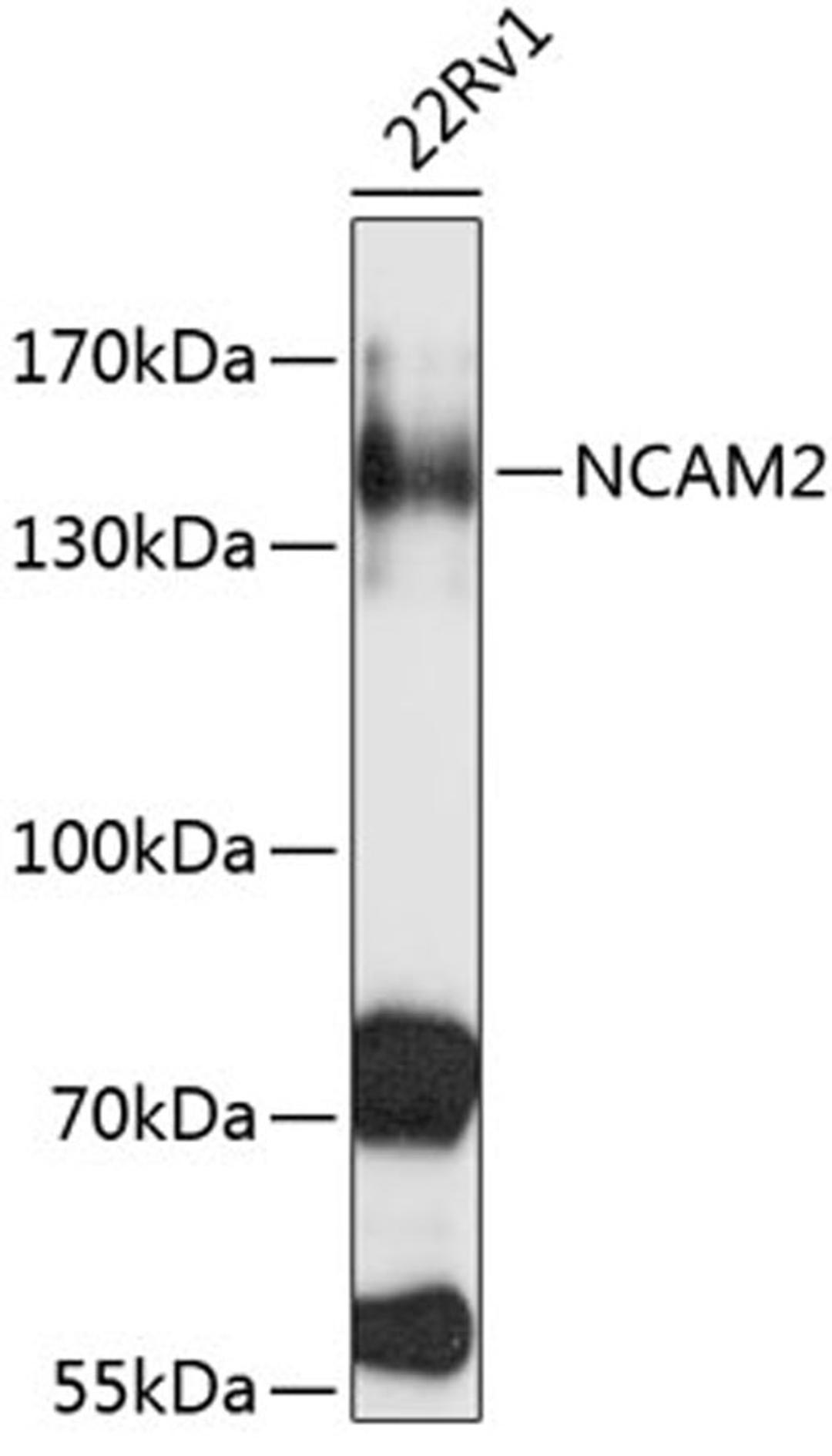 Western blot - NCAM2 antibody (A3973)