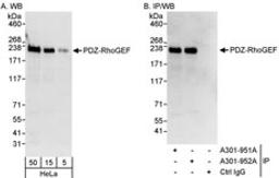 Detection of human PDZ-RhoGEF by western blot and immunoprecipitation.