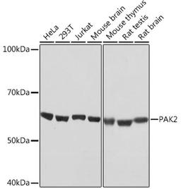 Western blot - PAK2 Rabbit mAb (A4553)