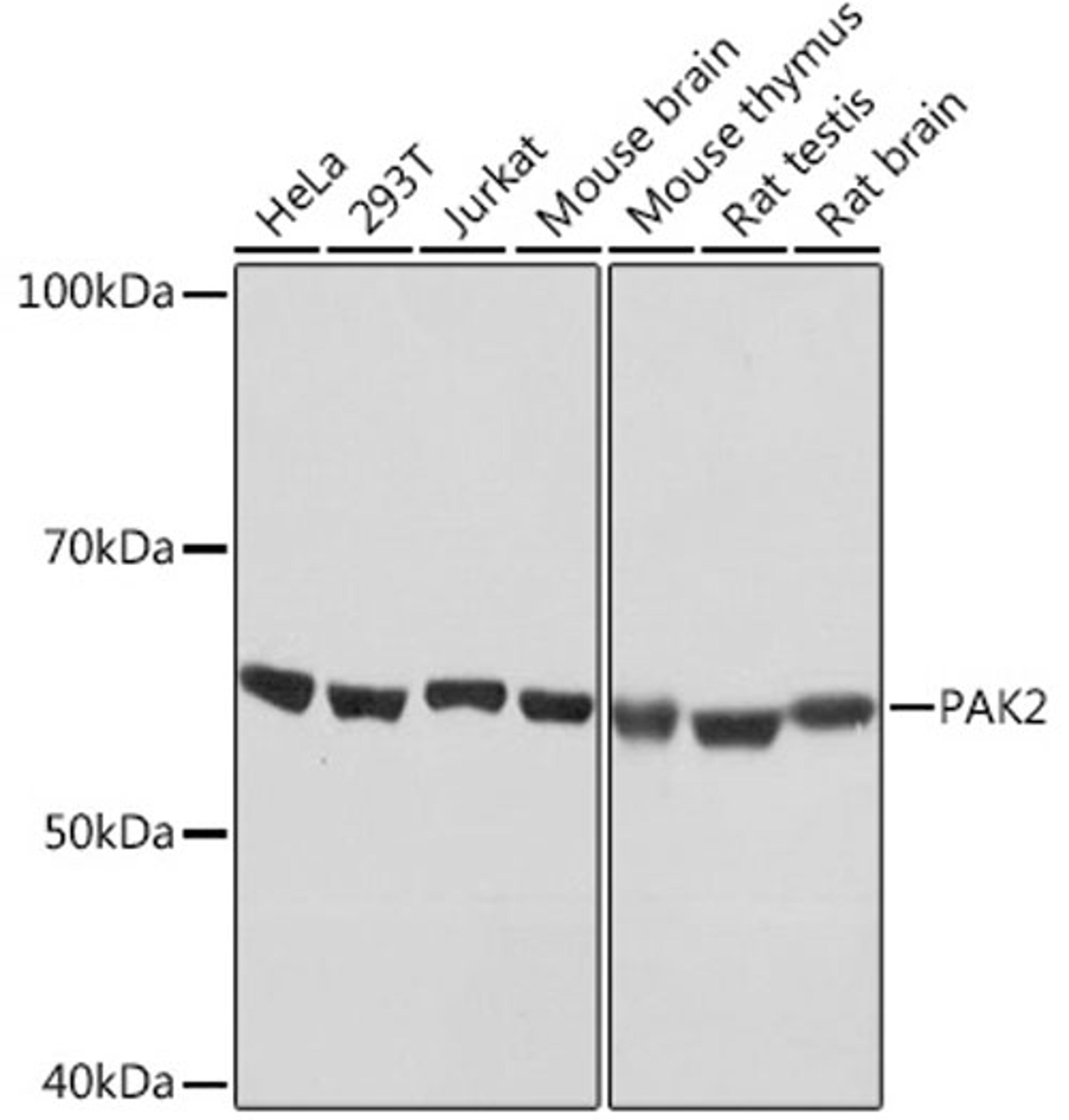 Western blot - PAK2 Rabbit mAb (A4553)