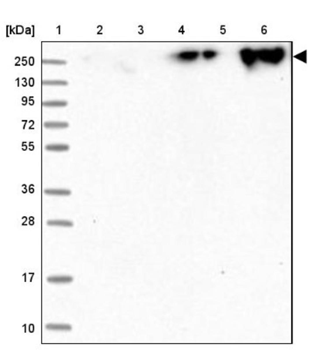 Western Blot: ZNF650 Antibody [NBP1-87996] - Lane 1: Marker [kDa] 250, 130, 95, 72, 55, 36, 28, 17, 10<br/>Lane 2: Human cell line RT-4<br/>Lane 3: Human cell line U-251MG sp<br/>Lane 4: Human plasma (IgG/HSA depleted)<br/>Lane 5: Human liver tissue<br/>Lane 6: Human tonsil tissue