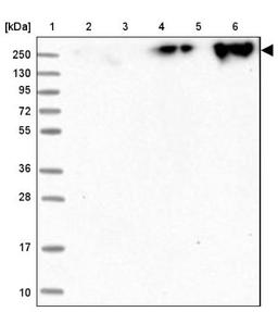 Western Blot: ZNF650 Antibody [NBP1-87996] - Lane 1: Marker [kDa] 250, 130, 95, 72, 55, 36, 28, 17, 10<br/>Lane 2: Human cell line RT-4<br/>Lane 3: Human cell line U-251MG sp<br/>Lane 4: Human plasma (IgG/HSA depleted)<br/>Lane 5: Human liver tissue<br/>Lane 6: Human tonsil tissue