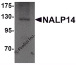 Western blot analysis of NALP14 in rat brain tissue lysate with NALP14 antibody at 1 &#956;g/mL.