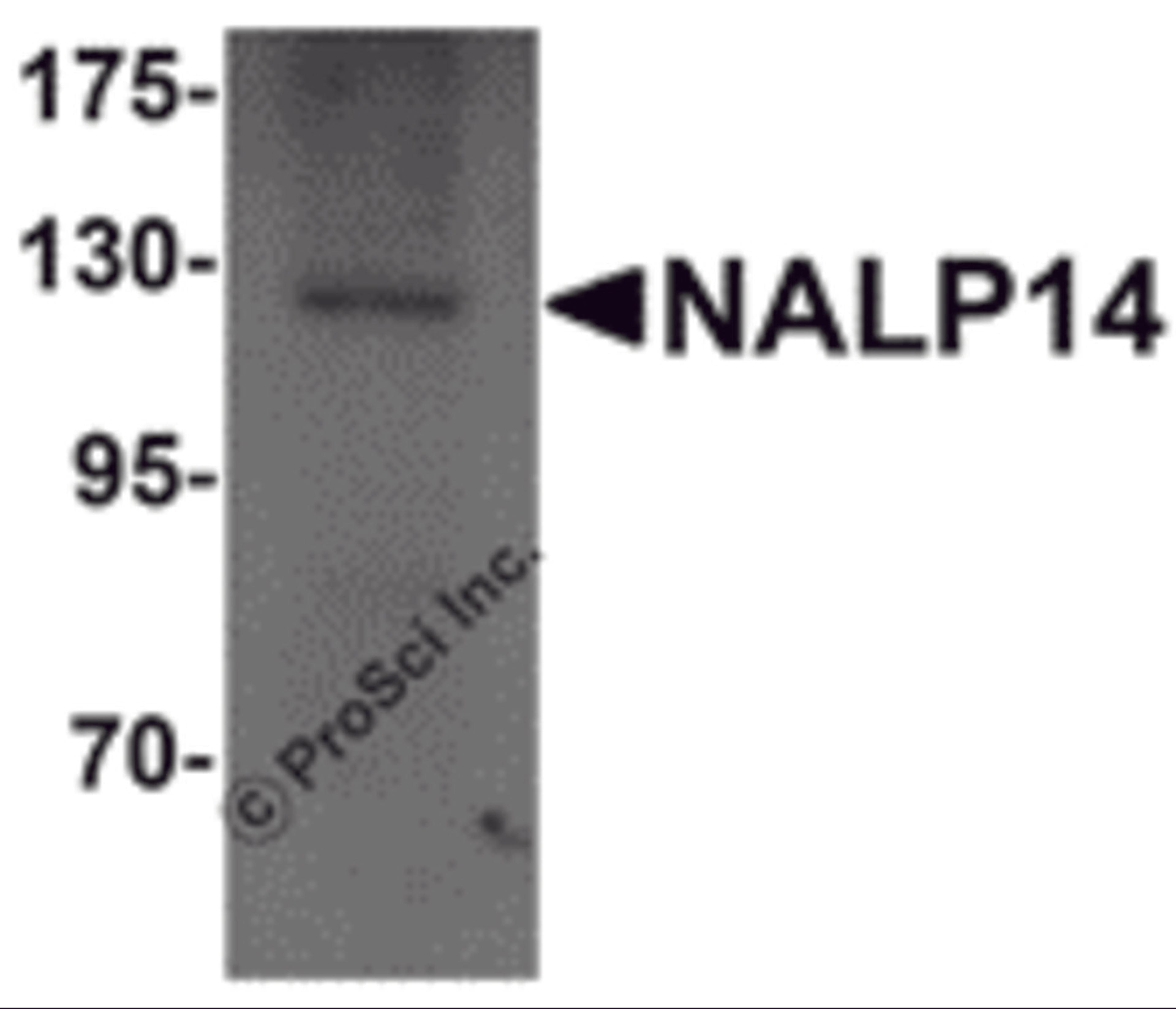 Western blot analysis of NALP14 in rat brain tissue lysate with NALP14 antibody at 1 μg/mL.