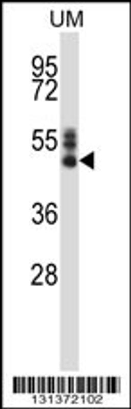 Western blot analysis in human uterine tomer tissue lysates (35ug/lane).