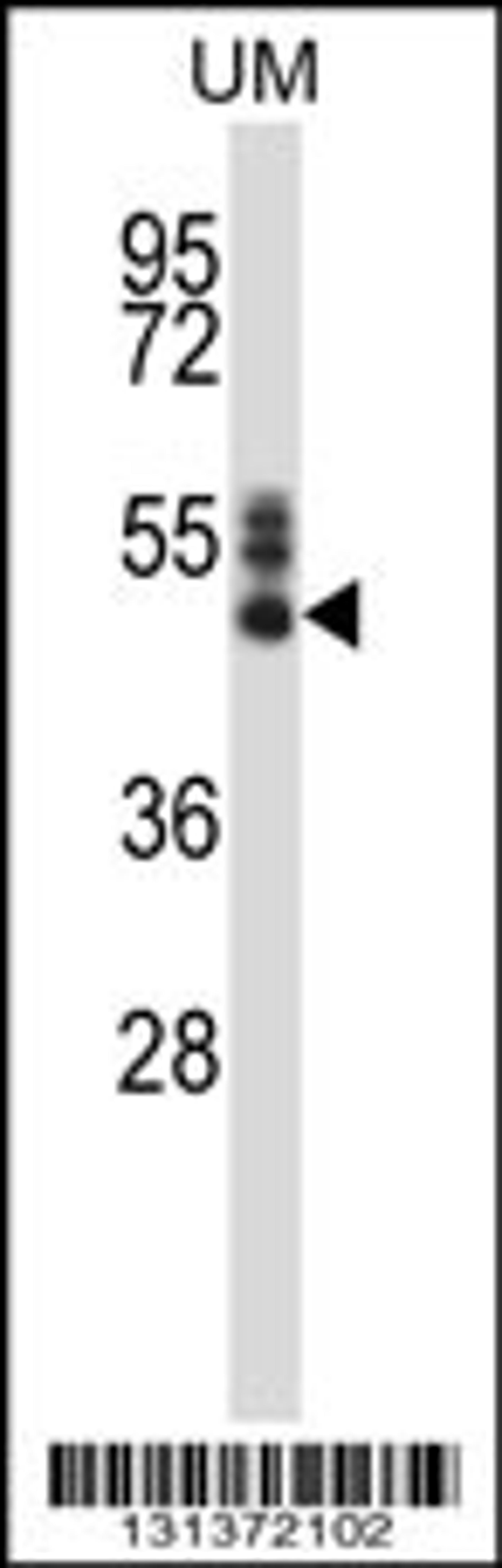 Western blot analysis in human uterine tomer tissue lysates (35ug/lane).