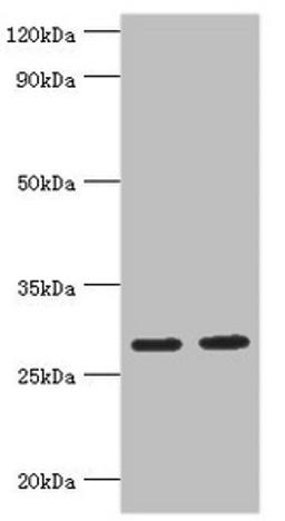 Western blot. All lanes: Ubiquitin-conjugating enzyme E2 J2 antibody at 5ug/ml. Lane 1: HepG2 whole cell lysate. Lane 2: Rat small intestine tissue. Secondary. Goat polyclonal to rabbit IgG at 1/10000 dilution. Predicted band size: 29, 25, 31 kDa. Observed band size: 29 kDa. 