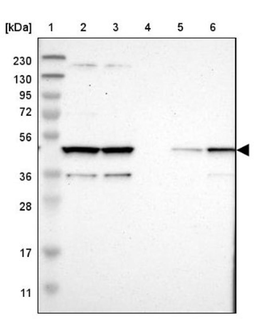 Western Blot: Cytohesin 3 Antibody [NBP1-90097] - Lane 1: Marker [kDa] 230, 130, 95, 72, 56, 36, 28, 17, 11<br/>Lane 2: Human cell line RT-4<br/>Lane 3: Human cell line U-251MG sp<br/>Lane 4: Human plasma (IgG/HSA depleted)<br/>Lane 5: Human liver tissue<br/>Lane 6: Human tonsil tissue