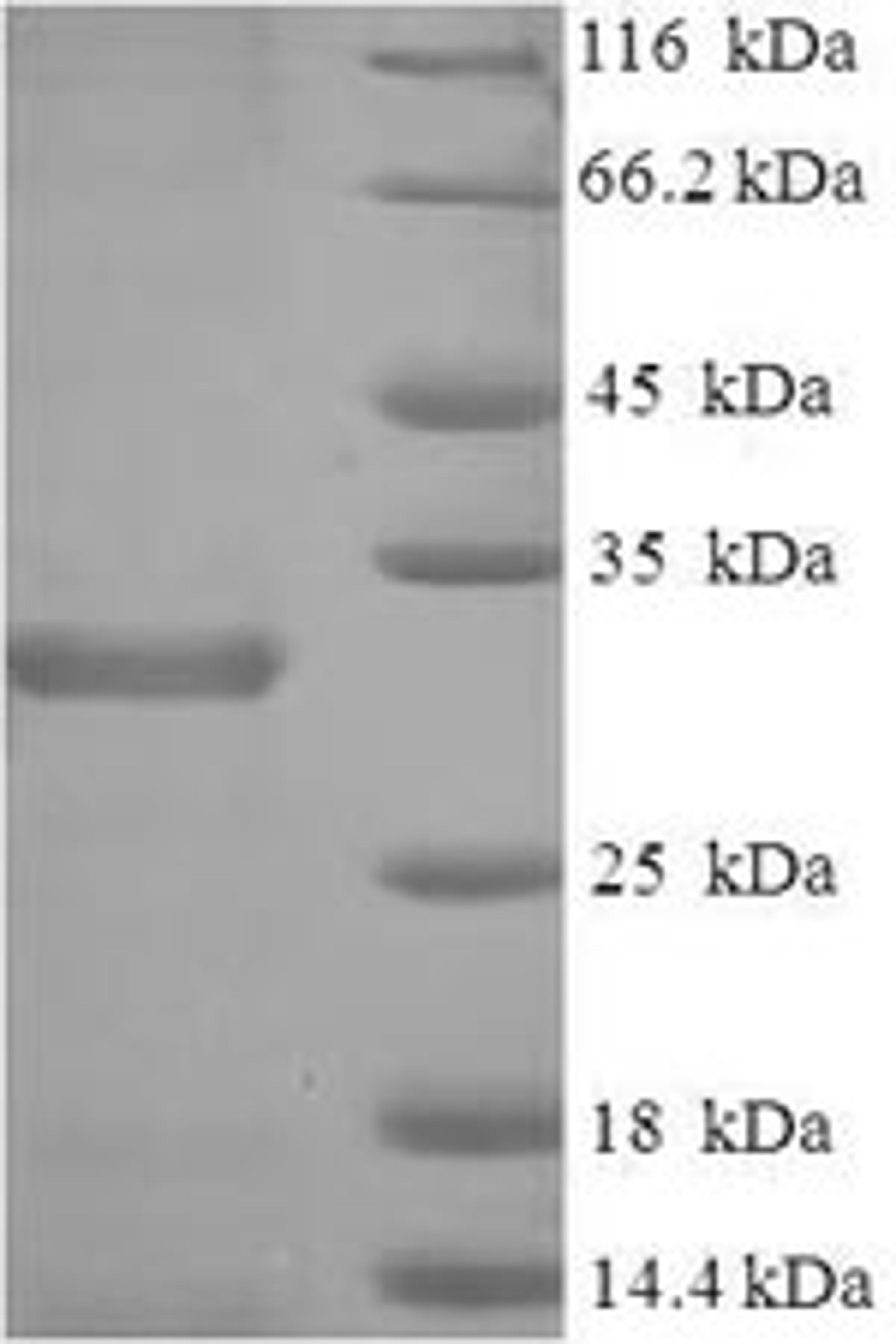 (Tris-Glycine gel) Discontinuous SDS-PAGE (reduced) with 5% enrichment gel and 15% separation gel.