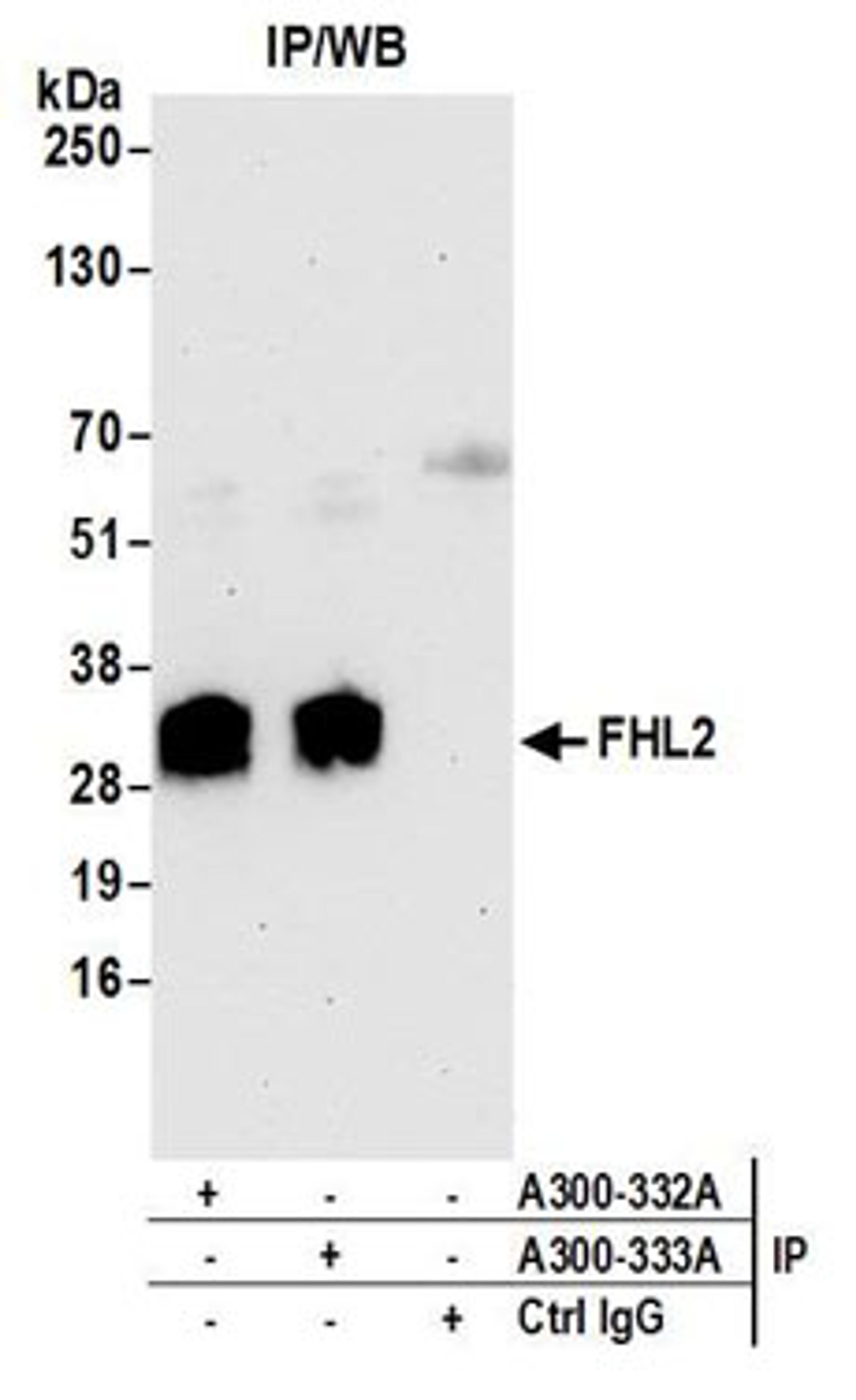 Detection of human FHL2 by western blot of immunoprecipitates.