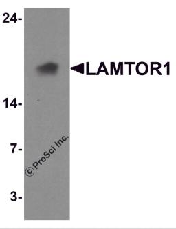 Western blot analysis of LAMTOR1 in A431 cell lysate with LAMTOR1 antibody at 1 μg/ml.