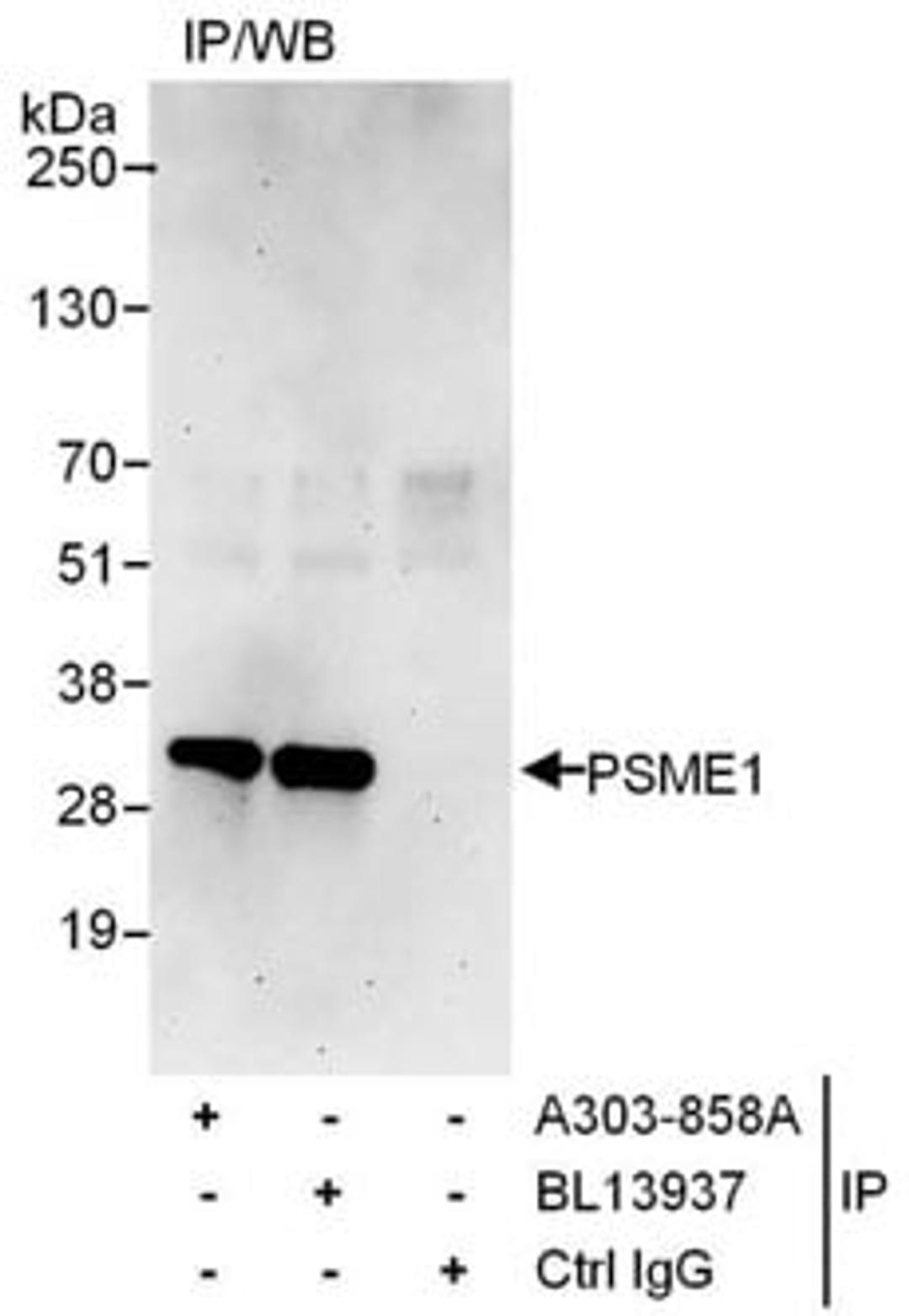 Detection of human PSME1 by western blot of immunoprecipitates.