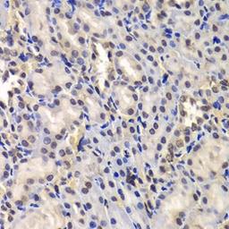 Immunohistochemical staining of Rat kidney tissue using DDX41 antibody