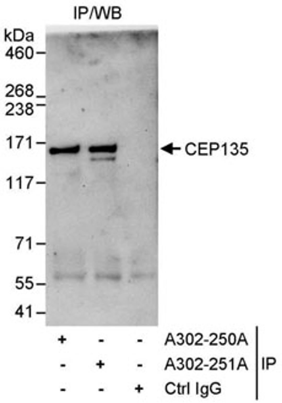 Detection of human CEP135 by western blot of immunoprecipitates.