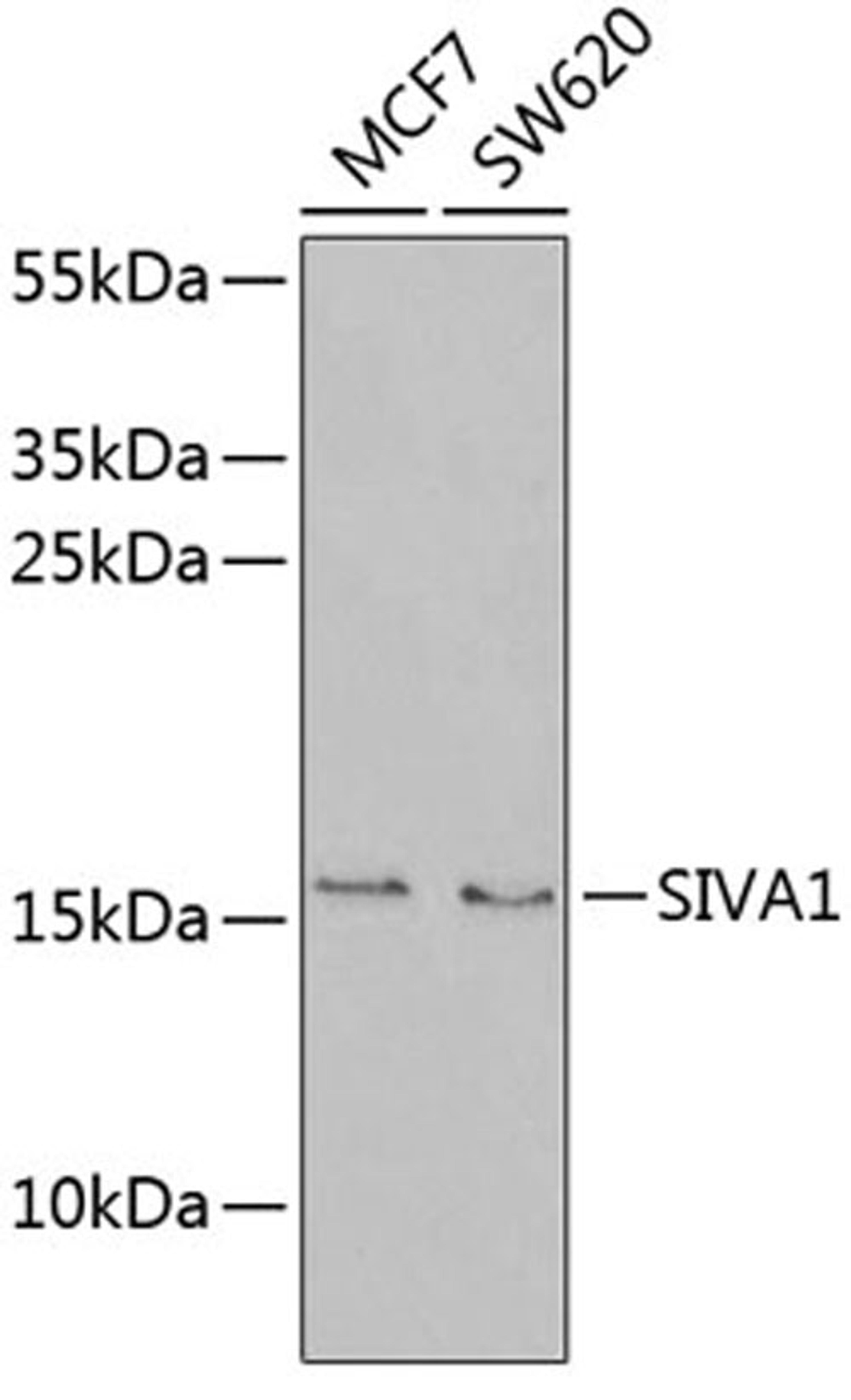 Western blot - SIVA1 antibody (A6326)