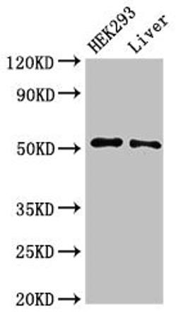 Western Blot. Positive WB detected in: HEK293 whole cell lysate, Rat liver tissue. All lanes: IFIT2 antibody at 3µg/ml. Secondary. Goat polyclonal to rabbit IgG at 1/50000 dilution. Predicted band size: 55 kDa. Observed band size: 55 kDa