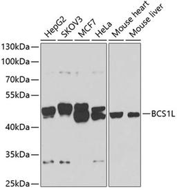 Western blot - BCS1L antibody (A7647)