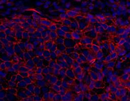 Detection of human SPTAN1/Alpha II-Spectrin by immunohistochemistry.