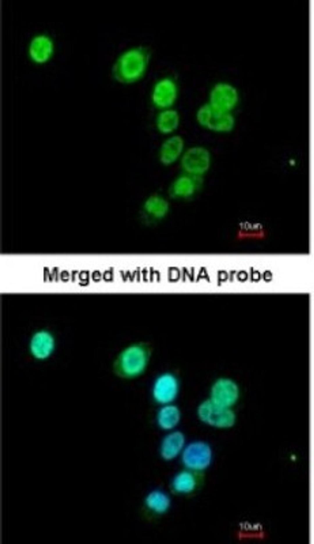 Immunocytochemistry/Immunofluorescence: RASAL1 Antibody [NBP1-32776] - Paraformaldehyde-fixed A549, using antibody at 1:200 dilution.