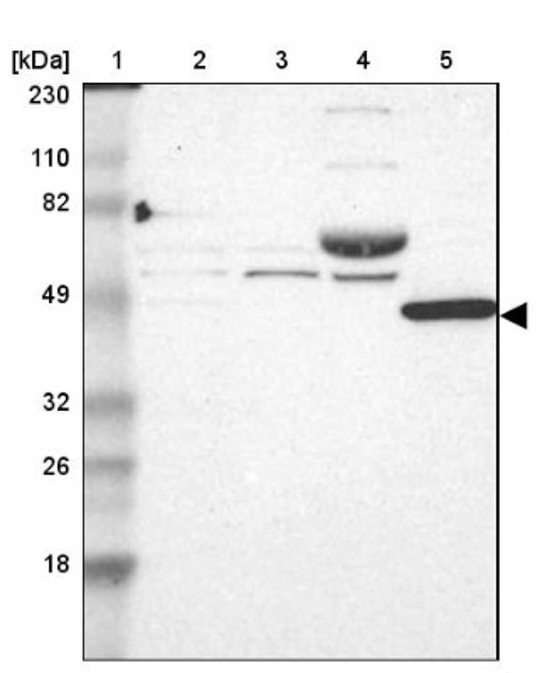 Western Blot: TNF Receptor II Antibody [NBP1-88139] - Lane 1: Marker [kDa] 230, 110, 82, 49, 32, 26, 18<br/>Lane 2: Human cell line RT-4<br/>Lane 3: Human cell line U-251MG sp<br/>Lane 4: Human plasma (IgG/HSA depleted)<br/>Lane 5: Human liver tissue