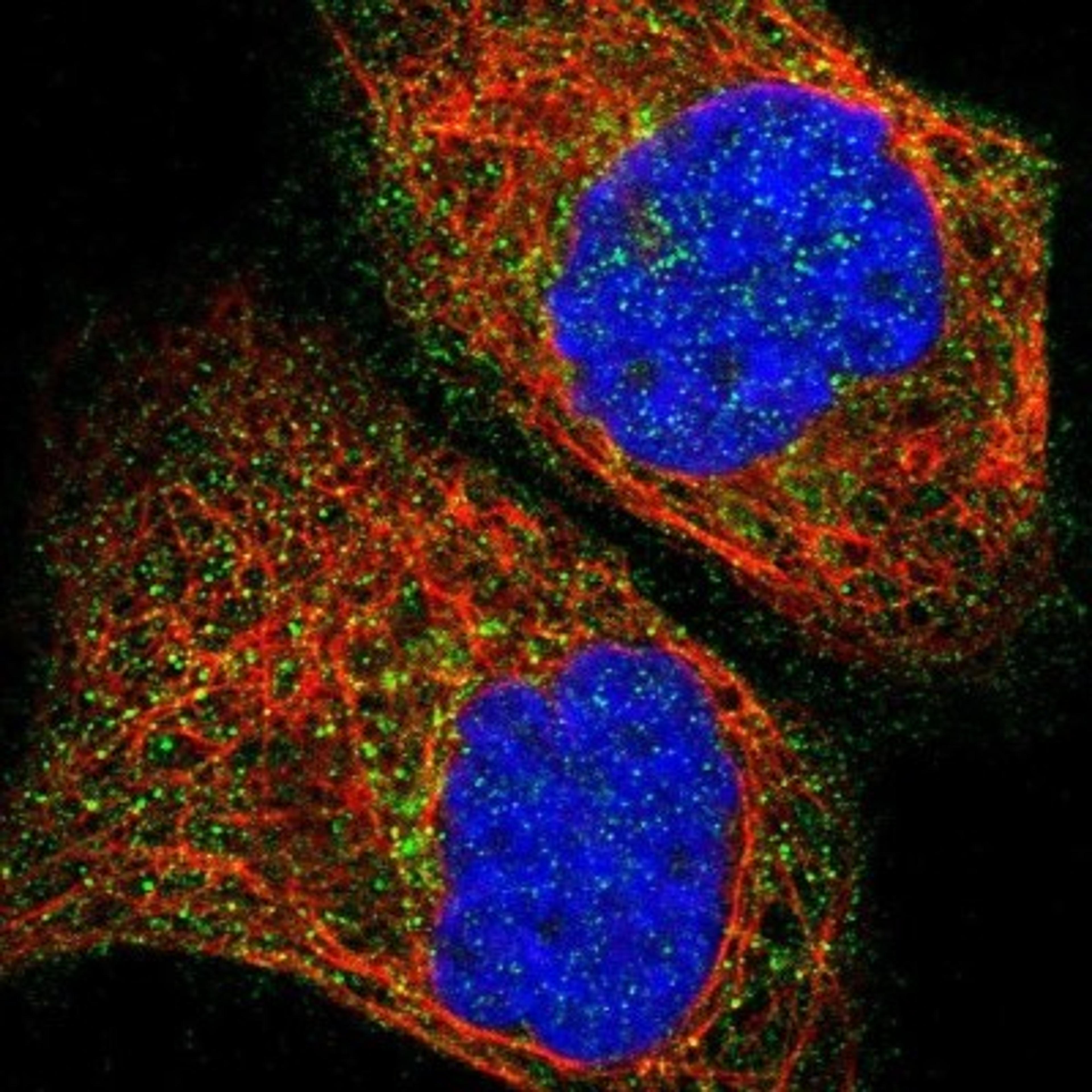 Immunocytochemistry/Immunofluorescence: RIPX Antibody [NBP1-89614] - Staining of human cell line A-431 shows positivity in cytoplasm.