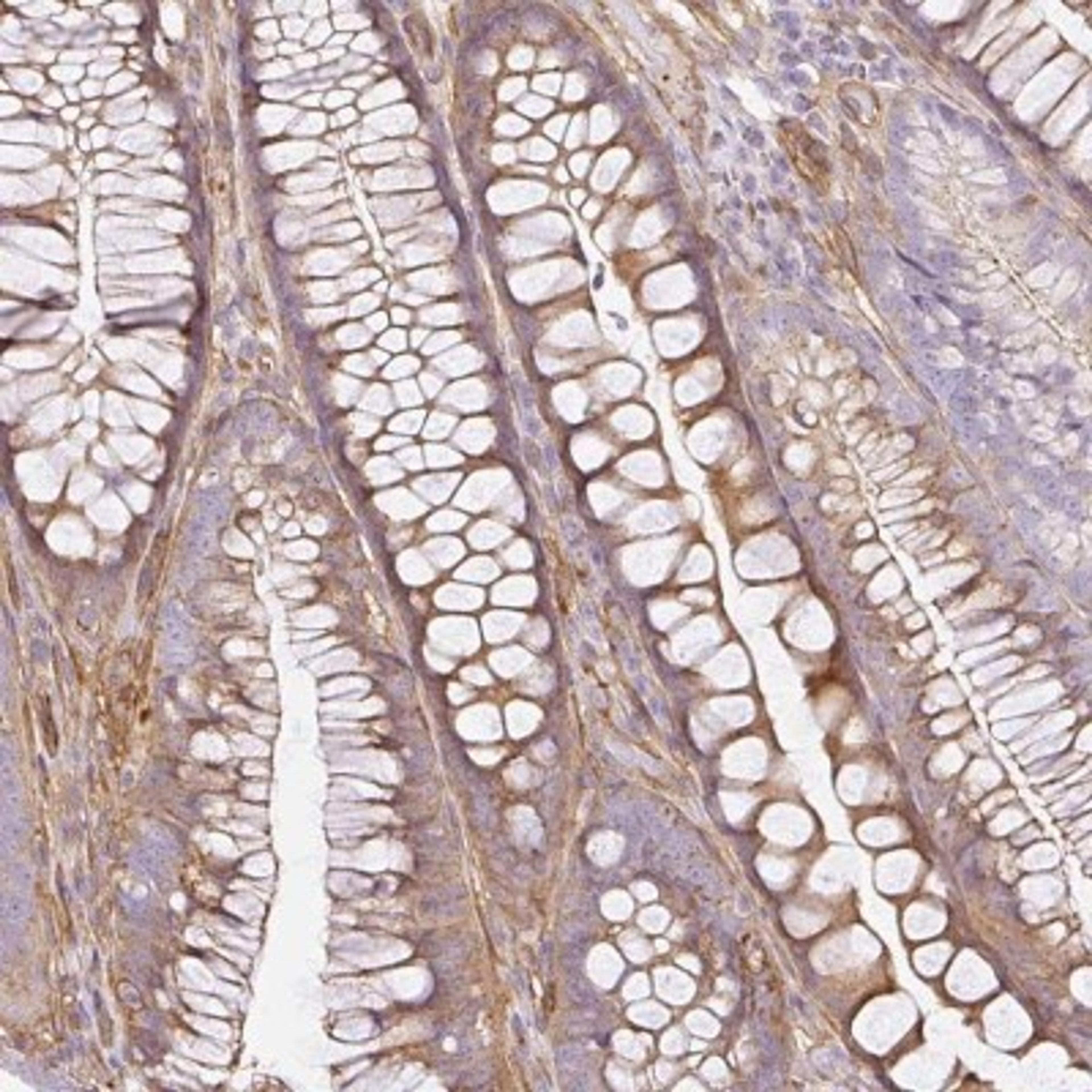 Immunohistochemistry: Sulfatase 1 Antibody [NBP2-31584] - Staining of human colon shows moderate cytoplasmic and membranous positivity in glandular cells.