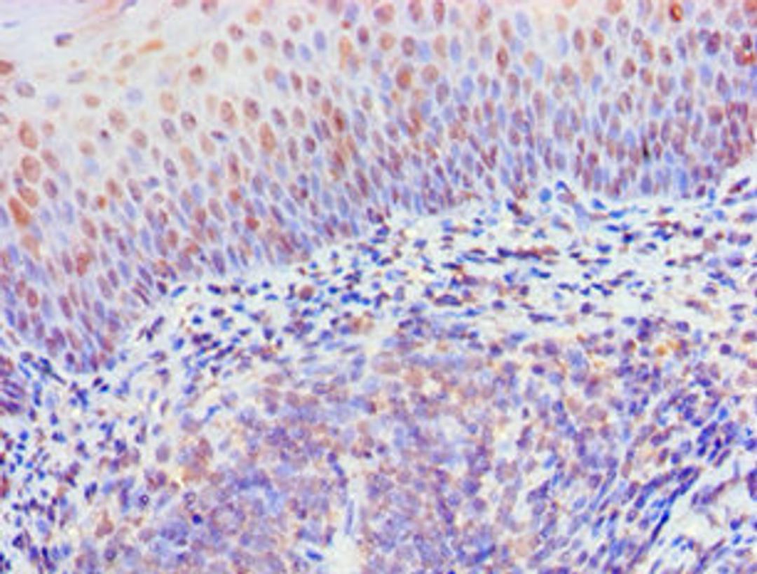 Immunohistochemistry of paraffin-embedded human tonsil tissue using CSB-PA897497ESR1HU at dilution of 1:100