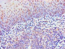 Immunohistochemistry of paraffin-embedded human tonsil tissue using CSB-PA897497ESR1HU at dilution of 1:100