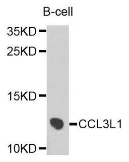 Western blot analysis of extracts of B cells using CCL3L1 antibody