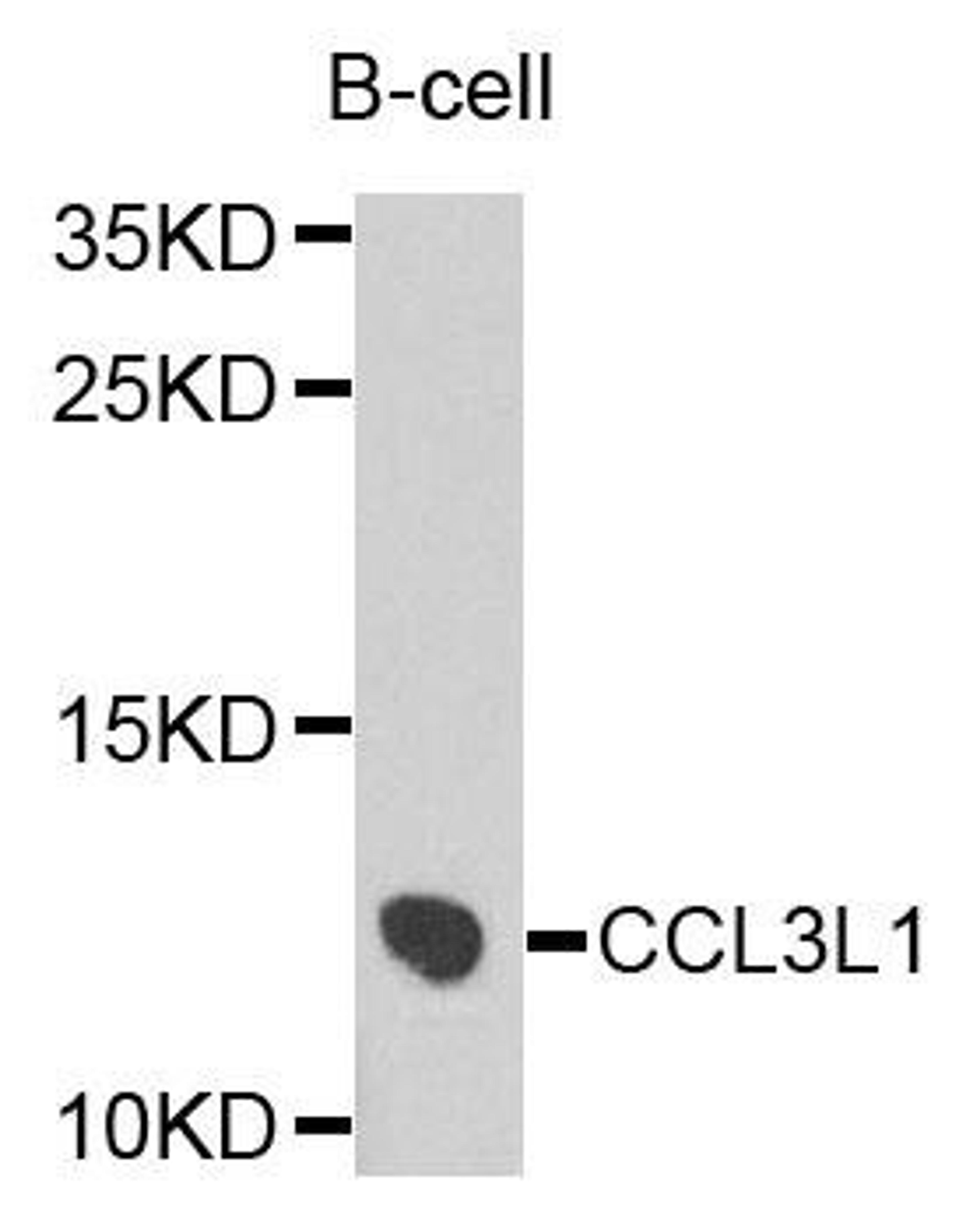 Western blot analysis of extracts of B cells using CCL3L1 antibody