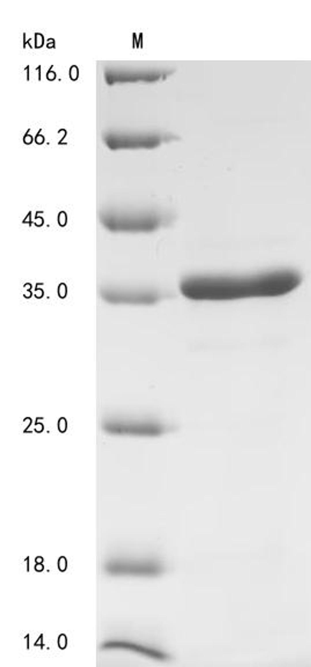 (Tris-Glycine gel) Discontinuous SDS-PAGE (reduced) with 5% enrichment gel and 15% separation gel.