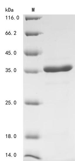 (Tris-Glycine gel) Discontinuous SDS-PAGE (reduced) with 5% enrichment gel and 15% separation gel.