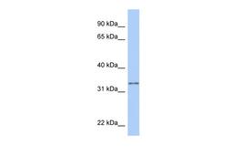 Antibody used in WB on Human HeLa at 0.2-1 ug/ml.