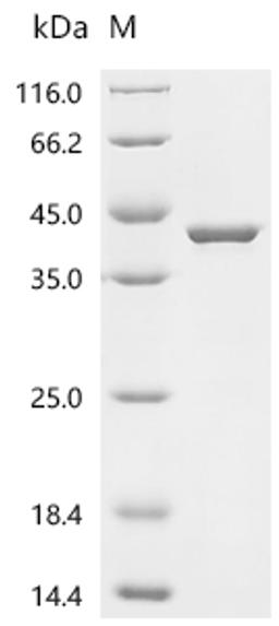 (Tris-Glycine gel) Discontinuous SDS-PAGE (reduced) with 5% enrichment gel and 15% separation gel.