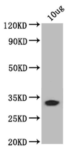 Western Blot. Positive WB detected in: recombinant protein. All lanes: bamB Antibody at 1:1000. Secondary. Goat polyclonal to rabbit IgG at 1/50000 dilution. Predicted band size: 31 kDa. Observed band size: 31 kDa.