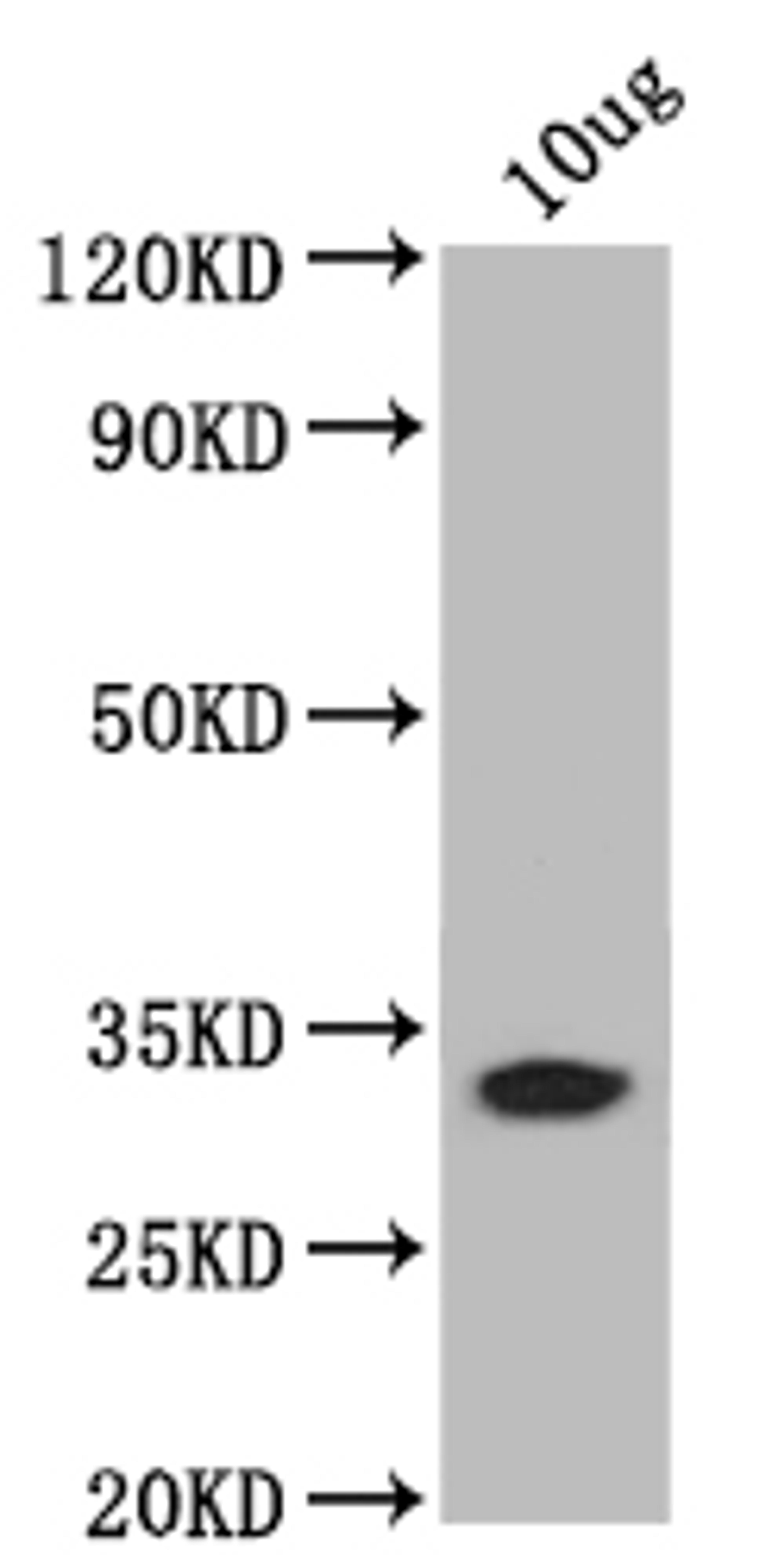 Western Blot. Positive WB detected in: recombinant protein. All lanes: bamB Antibody at 1:1000. Secondary. Goat polyclonal to rabbit IgG at 1/50000 dilution. Predicted band size: 31 kDa. Observed band size: 31 kDa.