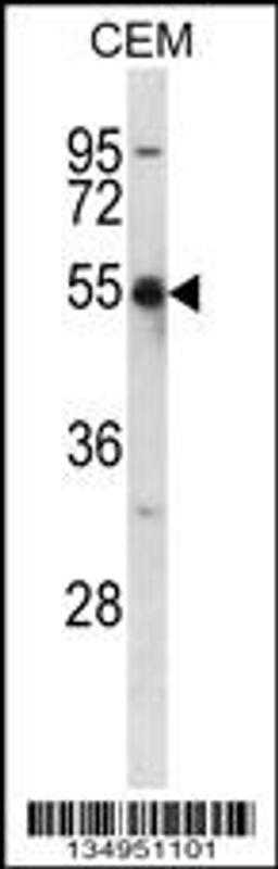 Western blot analysis in CEM cell line lysates (35ug/lane).