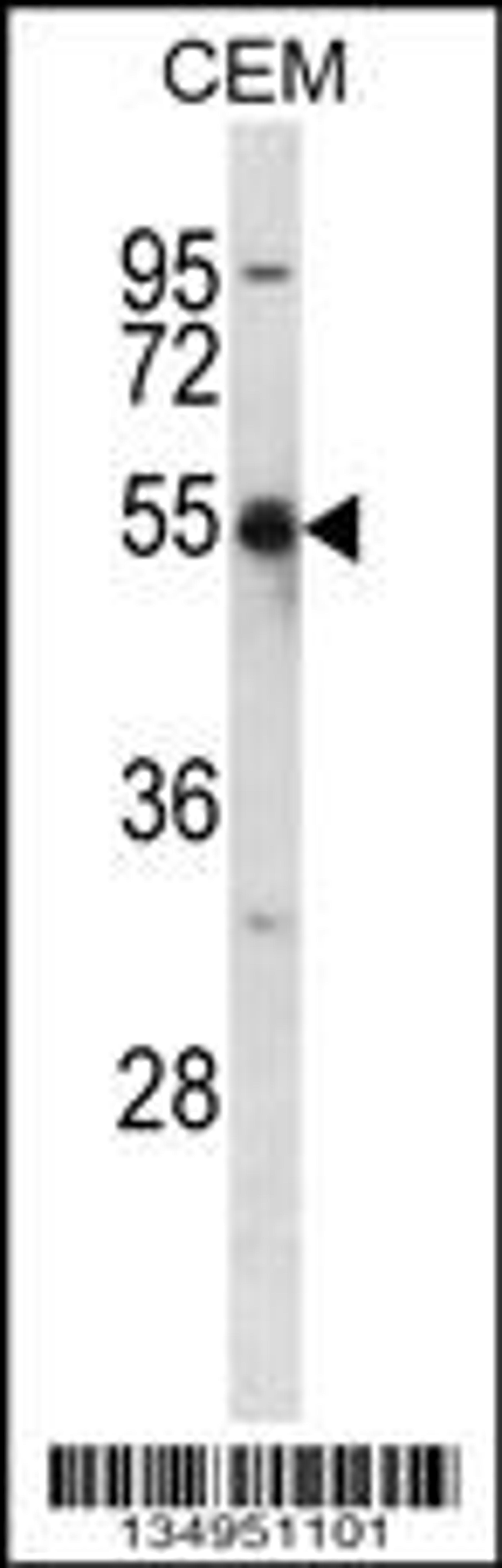 Western blot analysis in CEM cell line lysates (35ug/lane).