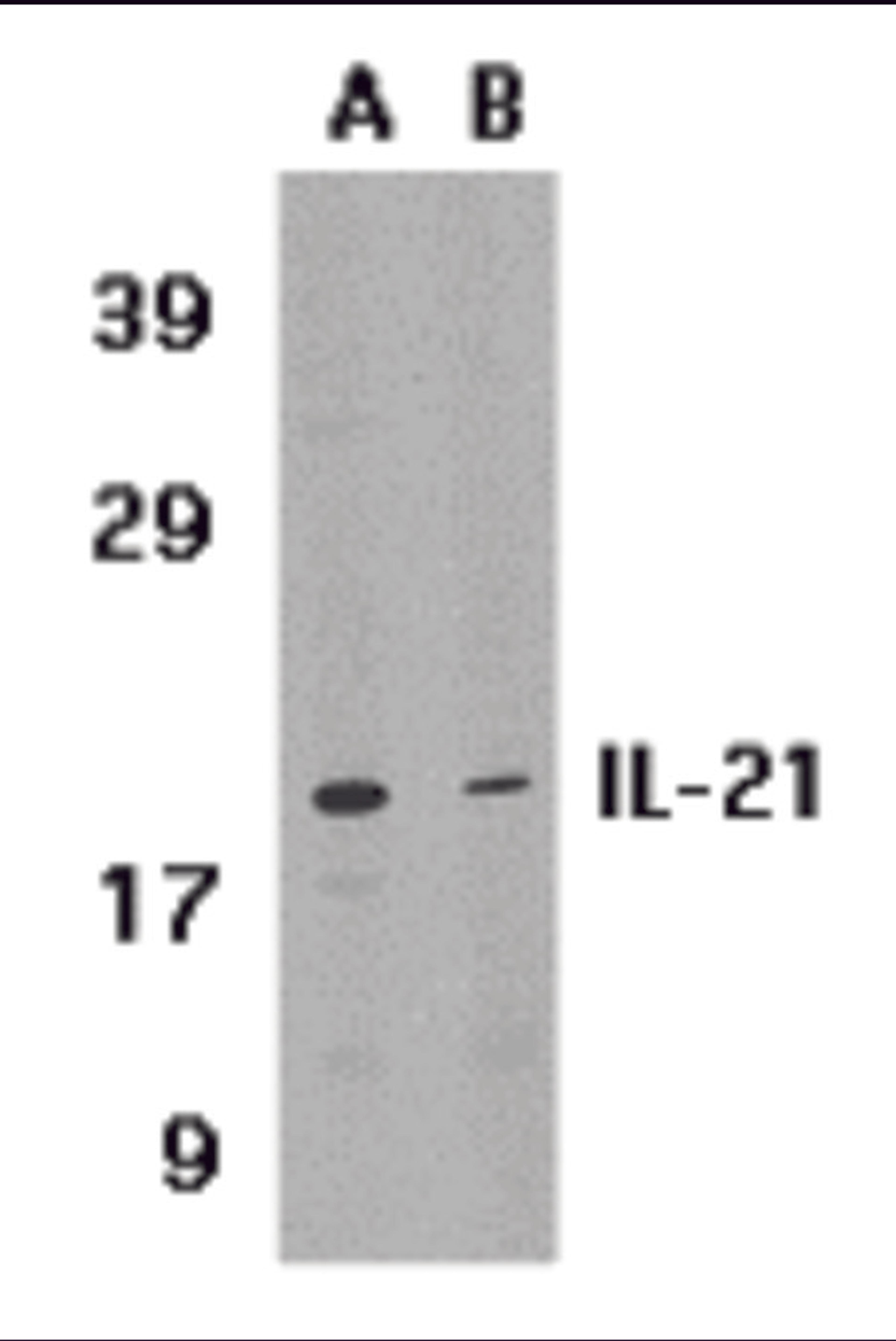 Western blot analysis of IL-21 expression in HL-60 cell lysate in (A) the absence or (B) the presence of blocking peptide with IL-21 antibody at 1 &#956;g /ml.