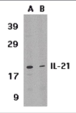 Western blot analysis of IL-21 expression in HL-60 cell lysate in (A) the absence or (B) the presence of blocking peptide with IL-21 antibody at 1 μg /ml.