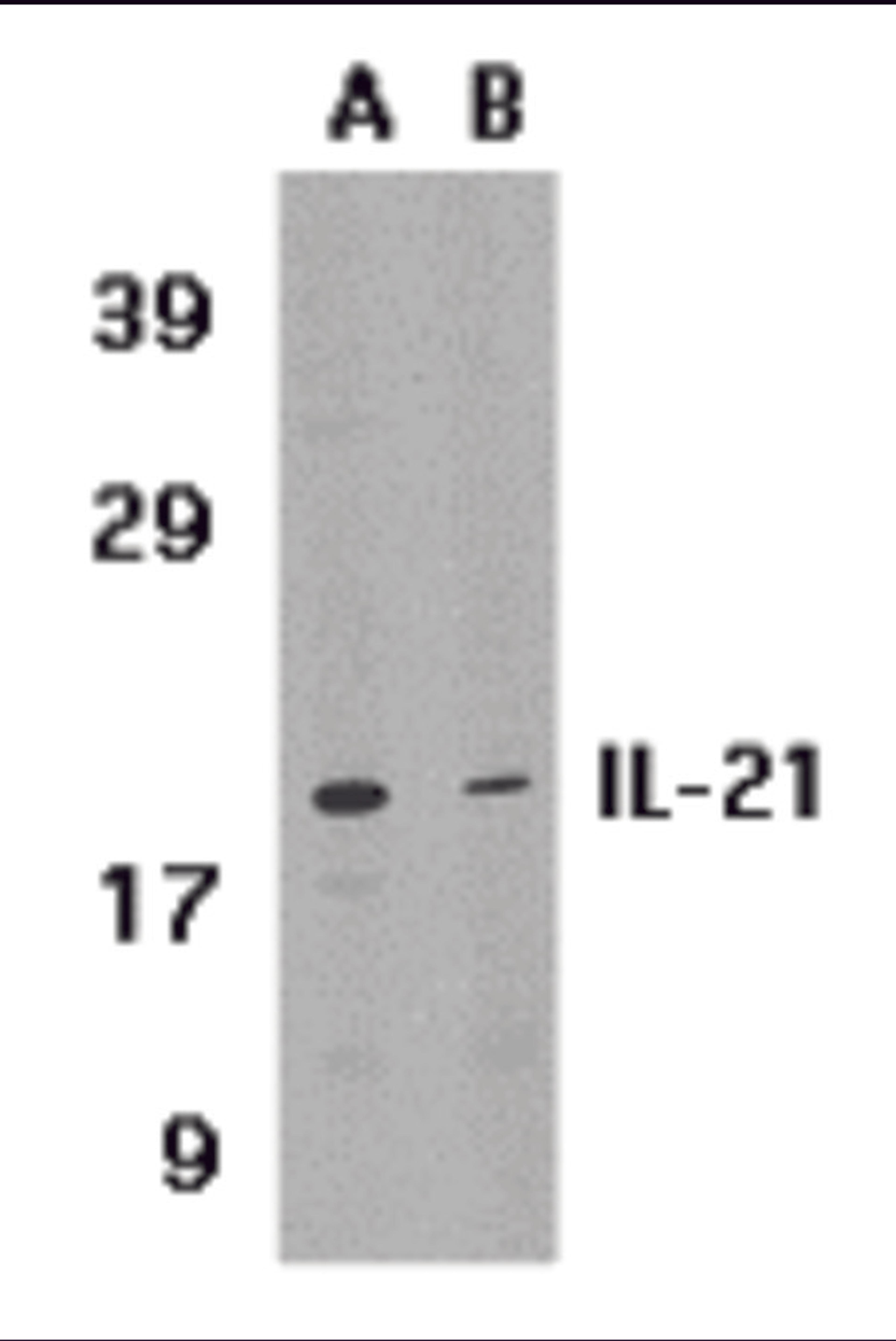 Western blot analysis of IL-21 expression in HL-60 cell lysate in (A) the absence or (B) the presence of blocking peptide with IL-21 antibody at 1 μg /ml.