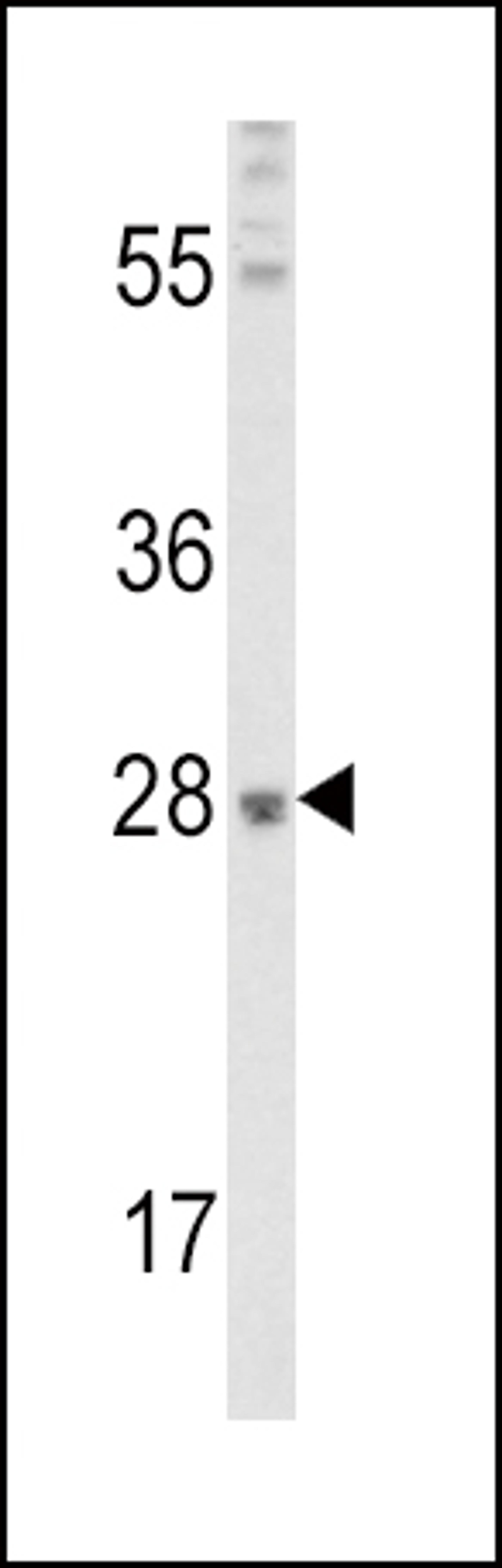 Western blot analysis of FGF10 Antibody in mouse lung tissue lysates (35ug/lane)