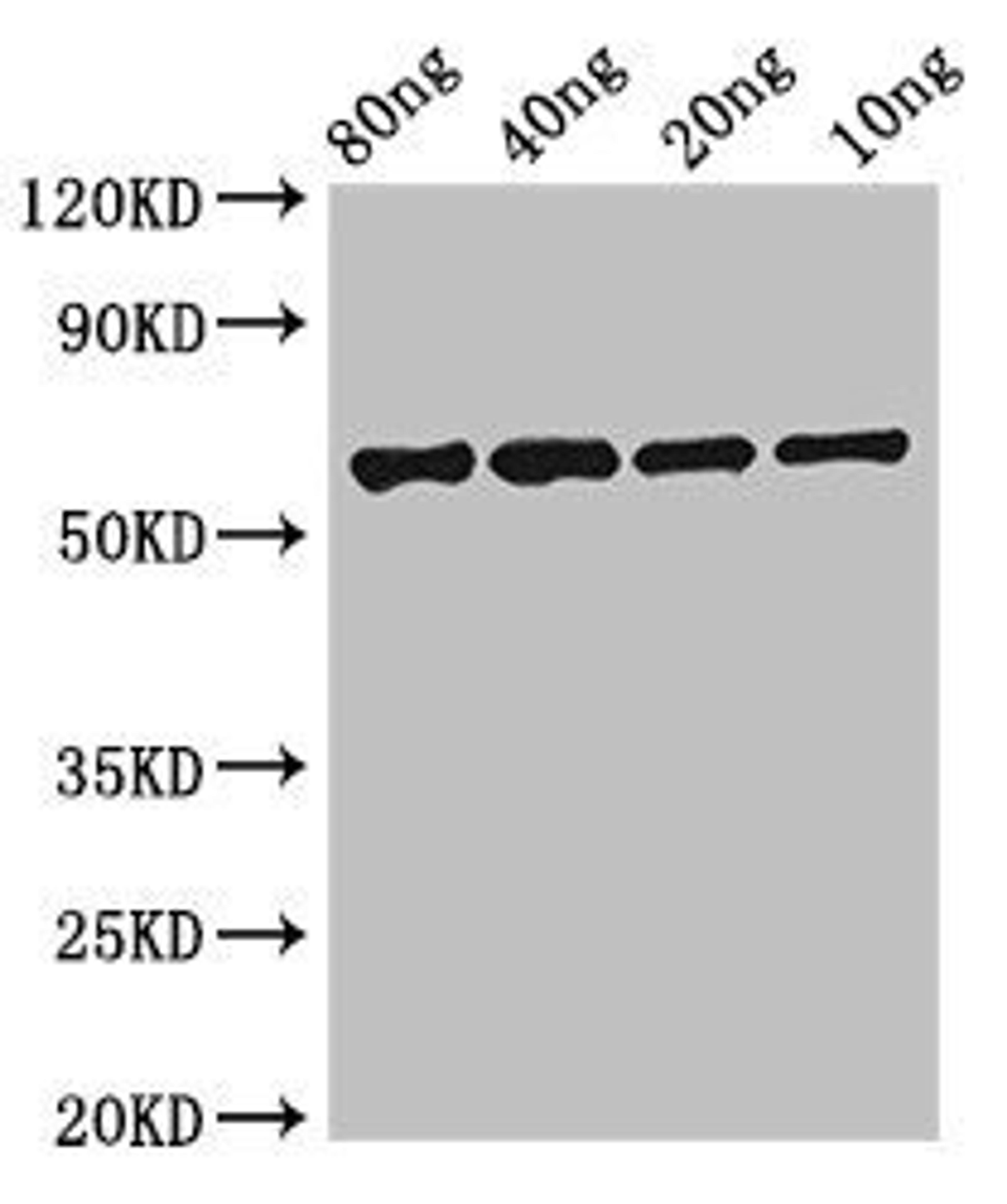 Western blot analysis of Recombinant protein using FSIP2 antibody