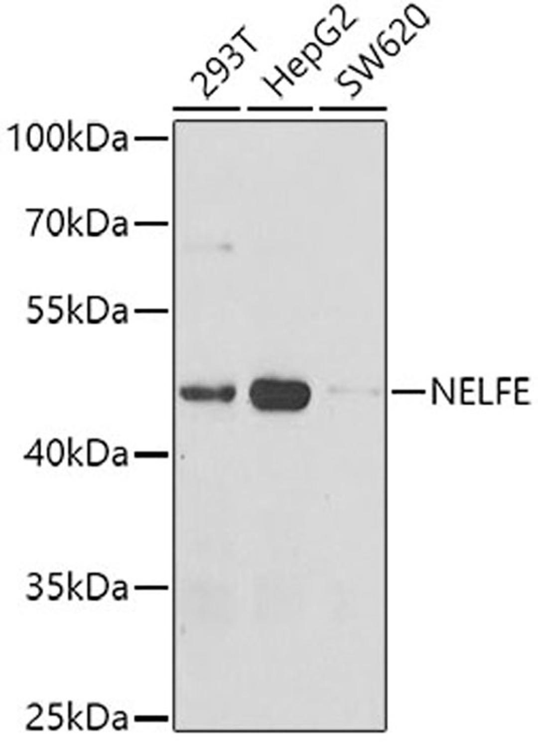 Western blot - NELFE antibody (A7006)