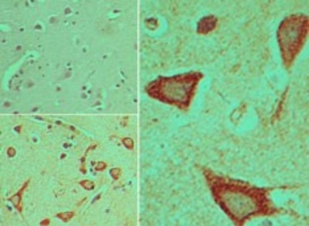 Immunohistochemistry-Paraffin: Dishevelled-3 Antibody [NBP2-24674] - Analysis of  Dishevelled-3 in formalin-fixed, paraffin-embedded human brain tissue using an isotype control (top left) and this antibody (bottom left, right) at 5 ug/ml.