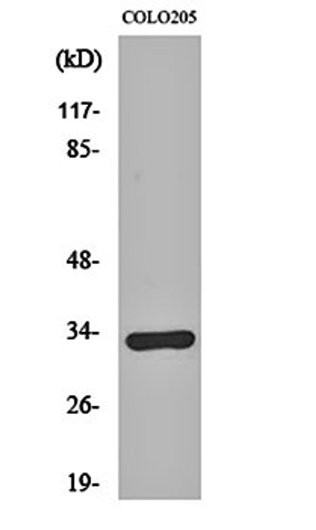 Western blot analysis of COLO205 cell lysates using Olfactory receptor 1B1 antibody