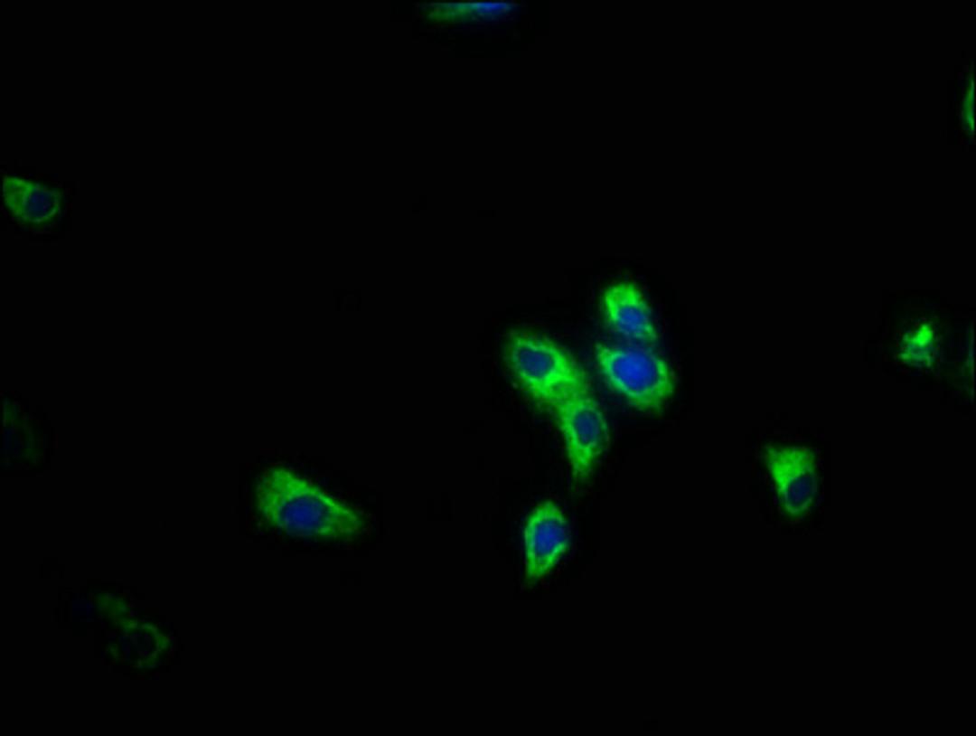 Immunofluorescence staining of HepG2 cells with CSB-PA841225LA01HU at 1:200, counter-stained with DAPI. The cells were fixed in 4% formaldehyde, permeabilized using 0.2% Triton X-100 and blocked in 10% normal Goat Serum. The cells were then incubated with the antibody overnight at 4°C. The secondary antibody was Alexa Fluor 488-congugated AffiniPure Goat Anti-Rabbit IgG(H+L).